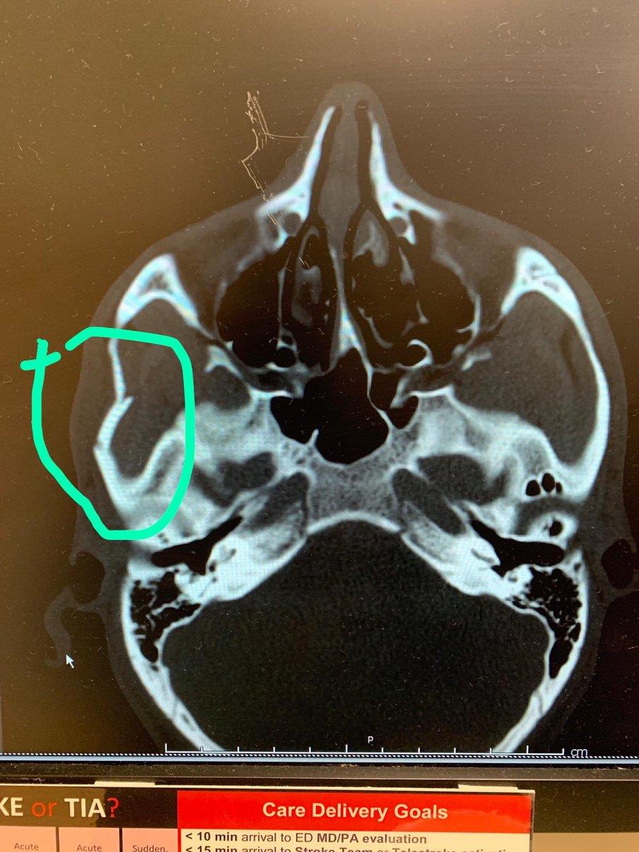 twitter.com/AmroAbdelAziz twitter.com/AmroAbdelAziz