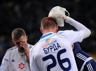 Динамо 0:0 Карпаты
