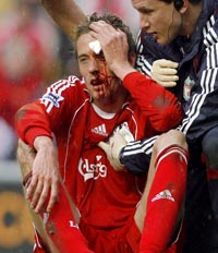 Питер Крауч, Getty Images