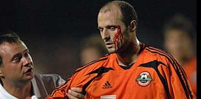 Травма Дуляя, shakhtar.com