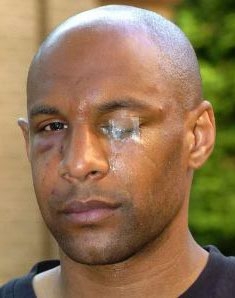 Осман Дабо после встречи с Бартоном