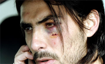 Дуду Ават, фото marca.com