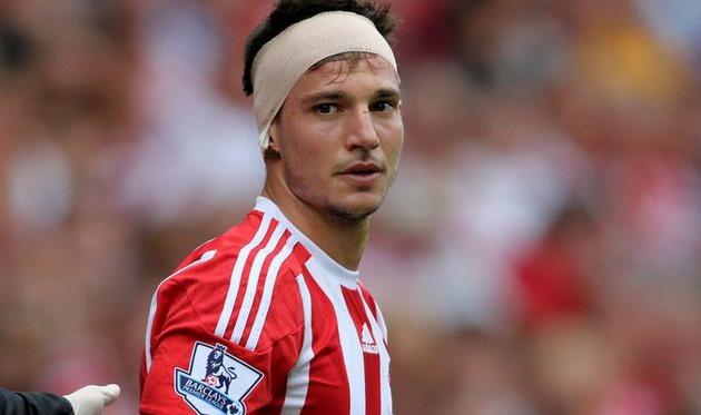 СЕДРИК СОАРЕС, REX