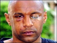 Дабо после встречи с Бартоном