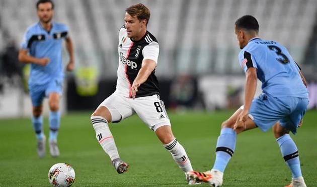 Ювентус - Лацио, Getty Images