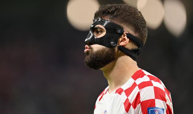 Йошко Гвардіол, getty images