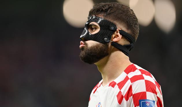 Йошко Гвардіол, getty images