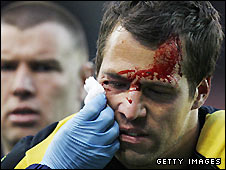 Томас Соренсен, Getty Images