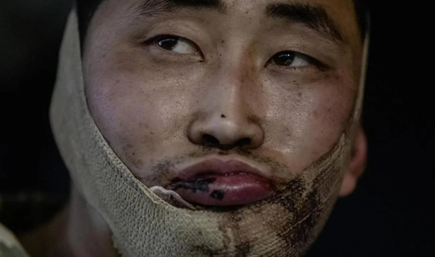 Полонений солдат з КНДР, Telegram/Zelenskiy