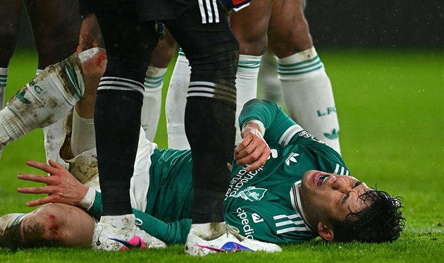 Ендо, Getty Images