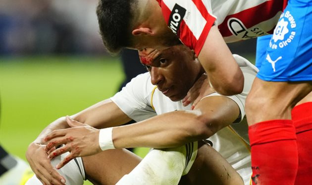 Реал Мадрид — Жирона, Getty Images