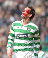 Веннегоор оф Хесселинк