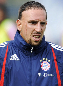 Франк Рибери